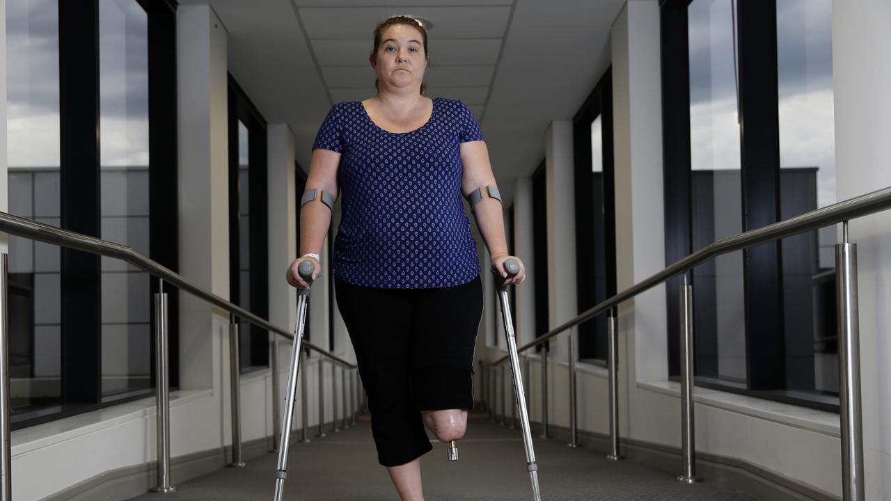 Paula Gowland had her leg amputated after contracting compartment syndrome. She is pictured at Norwest Private Hospital in Sydney.