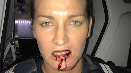 Senior Constable Maxine Phillips was attacked so fiercely by ice-addicted burglar Ahmed El Lababidi that her teeth ended up puncturing her lip.