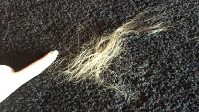 Loose hair as a result of injuries said to have been sustained by Heard during an incident with Depp at their Los Angeles home. Picture: Supplied