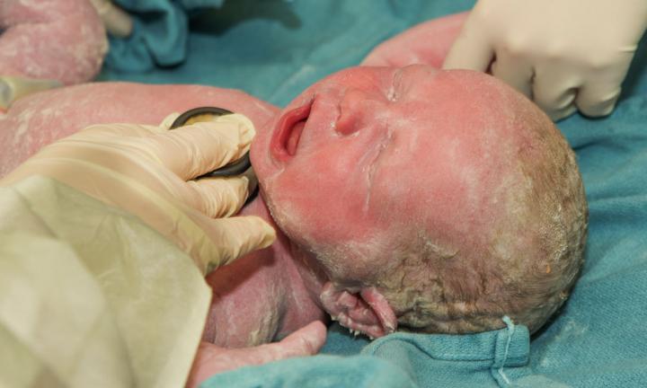 face presentation birth