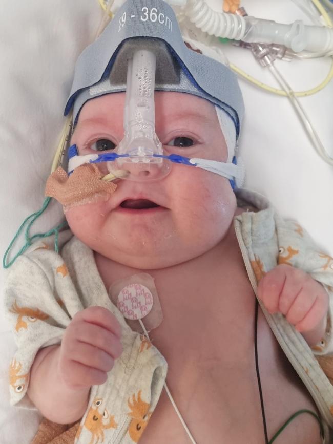 “Atticus” Nation, was born at Mercy Health to parents Simantha and Warwick, weighing in at just 807g, and struggled to breath from his first gasp of air.