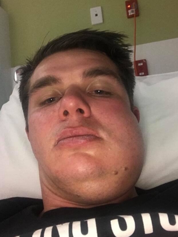 Trinity Old Scholars player Carl Teusner in hospital with a broken jaw. Picture: Supplied