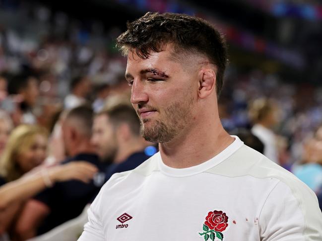 Tom Curry sporting his battle scars. Picture: David Rogers/Getty Images