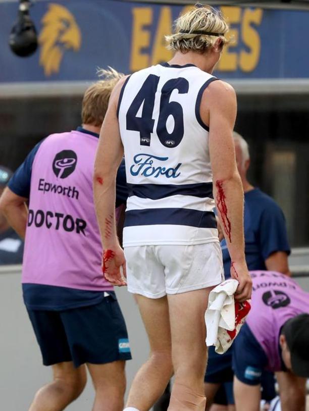 Mark Blicavs was left bloodied after an incident with the signage at the new Perth stadium. Picture: Getty