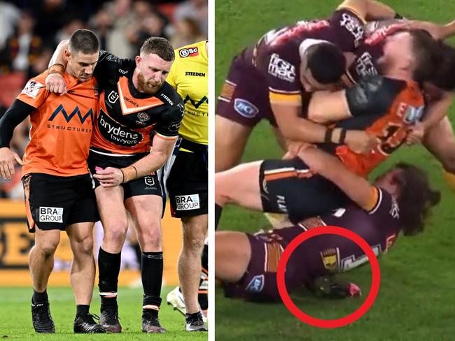 Jackson Hastings has a broken leg. Photo: Getty Images and Fox Sports