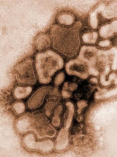 Microscopic view of the H1N1 influenza virus strain. A University of Queensland virologist has called for more detailed genetic analyses of circulating flu strains to learn more about possible changes that may indicate a bad season.