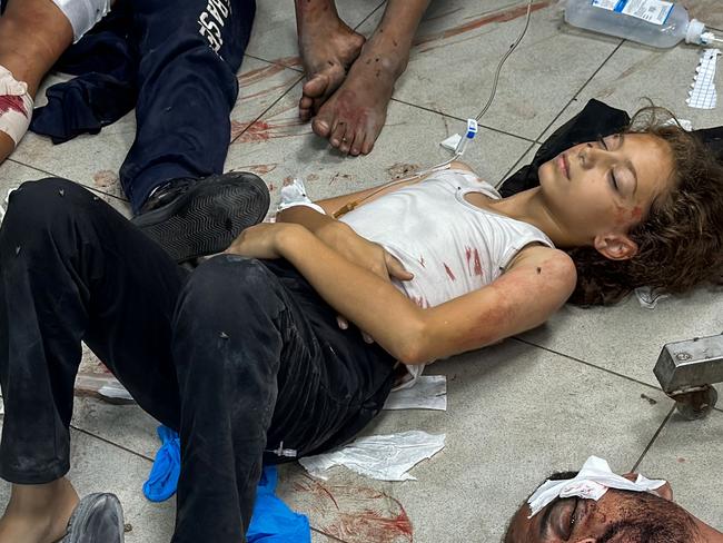 Palestinians injured in Israeli bombardment of the Beit Lahia Project area await treatment at the Kamal Adwan Hospital in Beit Lahia in the northern Gaza Strip. Picture: AFP