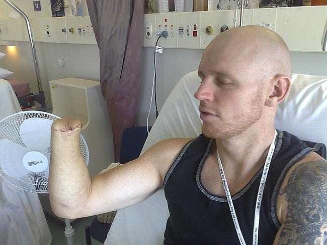 Paul in 2010, during his recovery after losing a hand and a leg from a suspected bull shark attack.