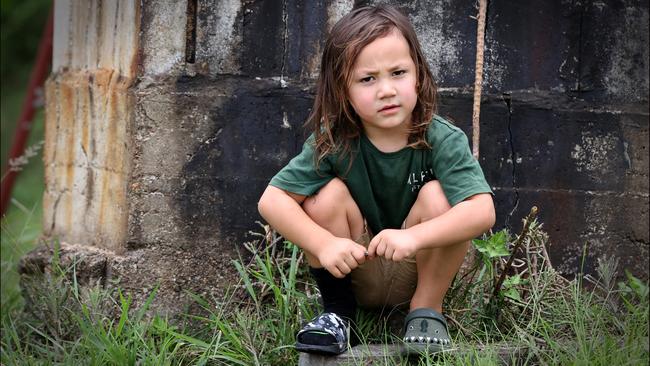 Manasseh Vui dropped a 10kg weight on his toe and had it amputated six days later. Picture: Jamie Hanson