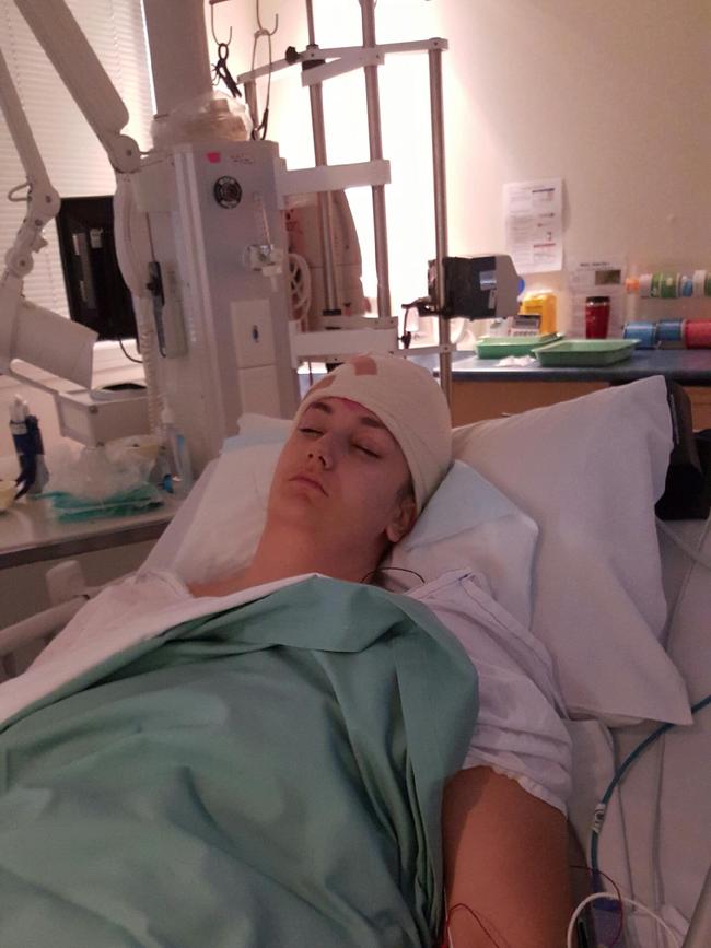 Amy Docherty was 17 when she underwent her first brain surgery. Picture: Supplied