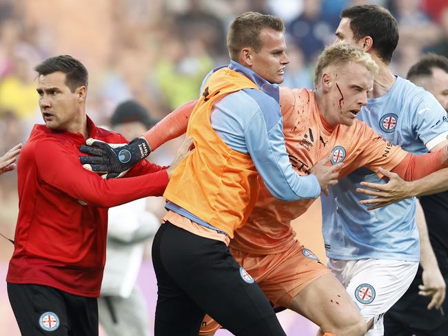 Melbourne City goalkeeper Tom Glover is helped from AAMI Park.