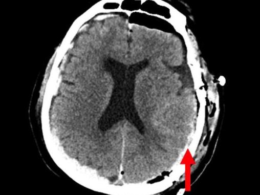 First-ever recording of a dying human brain reveals what happens when we die. Picture: Frontiers in Aging Neuroscience