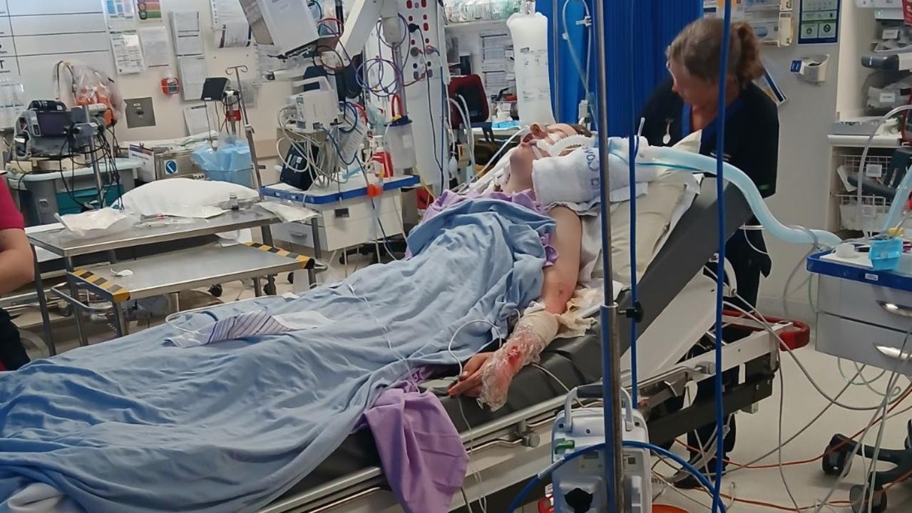 The Year 7 student from Kepnock High School in Bundaberg recovering from his severe burns in the Royal Brisbane and Women’s Hospital.