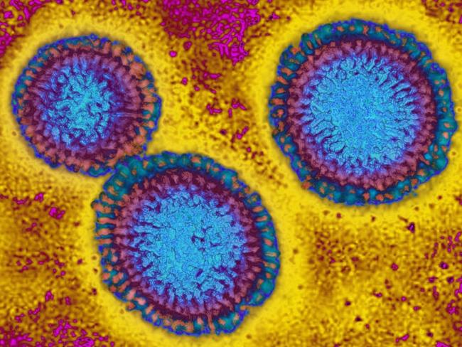 An image taken with transmission electron microscopy of the Influenza virus. Picture: BSIP/UIG via Getty Images