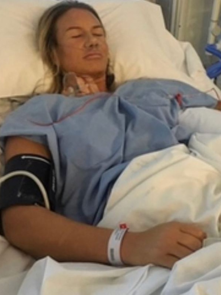 Alexa almost died in 2017 when she had an anaphylactic reaction to antibiotics after surgery.