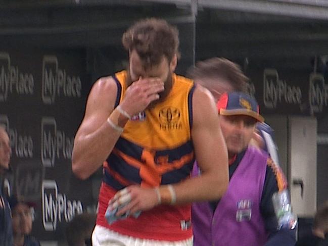 Riley Thilthorpe injury pic is here