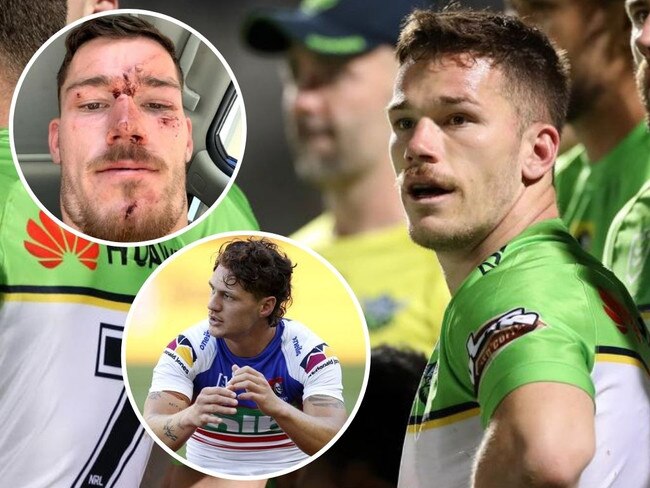 Starling arrest: Ponga among NRL stars caught in crossfire