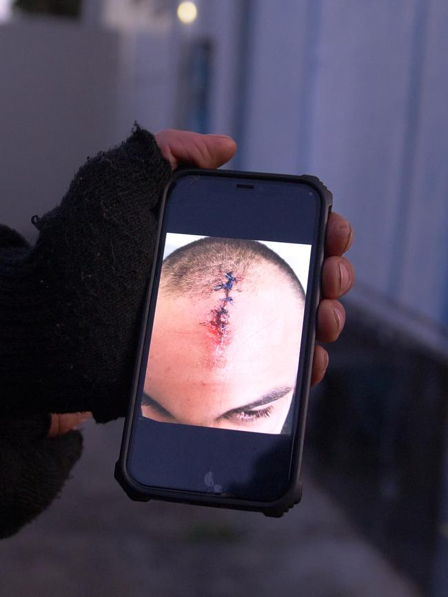 Ramadan Osman was struck in the head by a stray bullet.
