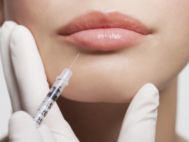 Close up of woman receiving botox injection in lips - stock photo.
