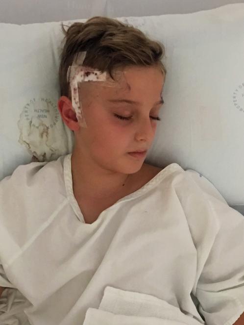 Jack after surgery on his brain tumour.