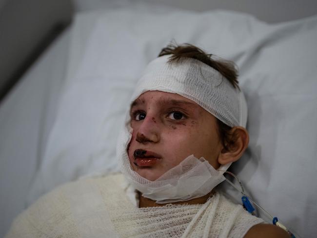 BEIRUT, LEBANON - OCTOBER 7: 11-year-old Mohammed from Ayn al-Dilib lies in bed at Geitaoui Hospital after receiving serious injuries in an Israeli airstrike, on October 7, 2024 in Beirut, Lebanon. Hundreds of thousands of people have fled Lebanon in recent weeks, as Israel has ramped up its attacks on Hezbollah, the Iran-backed militant and political group. Israel is conducting daily airstrikes in the capital and elsewhere in the country, while expanding its ground operation in the south. (Photo by Carl Court/Getty Images)