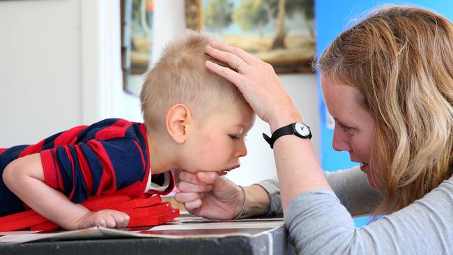 Roki, 3, lifting his head, an amazing achievement for a boy born with severe brain damage. Picture: Troy Snook