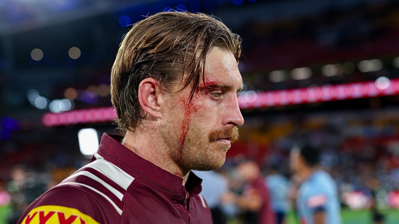 Maroons star Cameron Munster leaves the field in Origin I battered and bloodied.