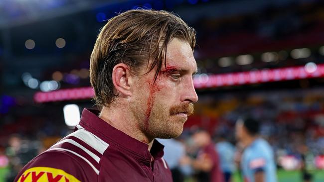 Maroons star Cameron Munster leaves the field in Origin I battered and bloodied.