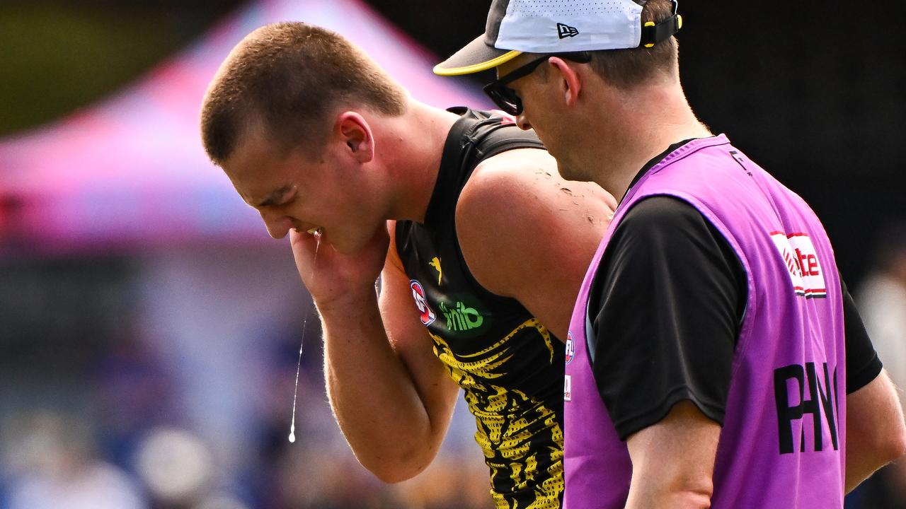 Sam Lalor will undergo surgery for a fractured jaw. (Photo by Daniel Carson/AFL Photos via Getty Images)