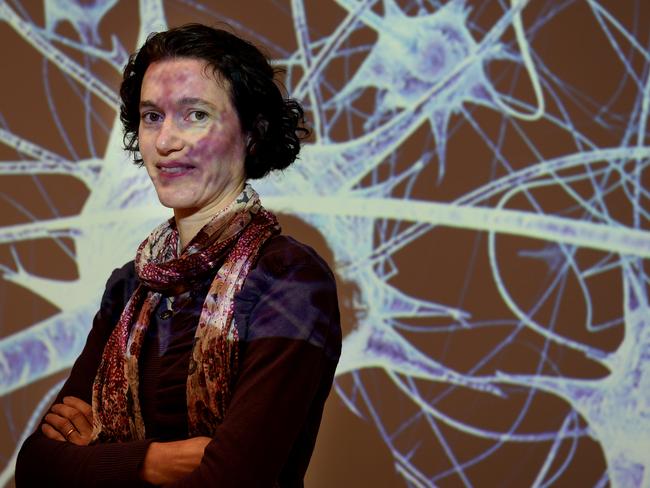 Major work needs financial support ... Dr Fiona Bruinsma of the Cancer Council is researching into uncommon cancers people get and to raise more awareness about them.