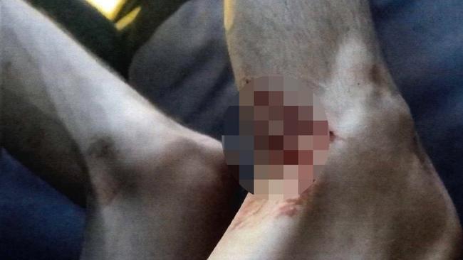 Stab wounds suffered by Jack Brearley, 23, who is one of four people accused of murdering Cassius Turvey. Mr Brearley alleges he received stab wounds from Cassius Turvey before the schoolboy was fatally struck by co-accused Brodie Palmer, an allegation Palmer denies. Picture: WA Police,