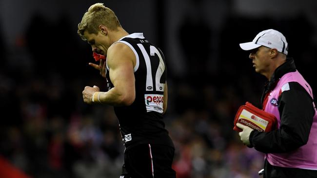 St Kilda is confident Nick Riewoldt will be available to play against Melbourne despite a concussion issue.