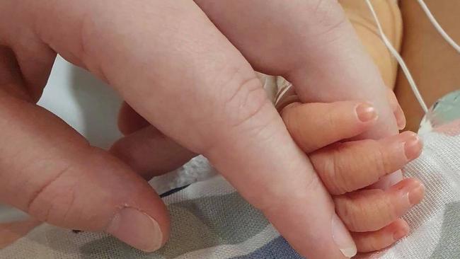 Tassie's Miracle Bubs: Little Haddie Filisetti has had a rough start to life, having two open heart surgeries since she came into the world just seven weeks ago.