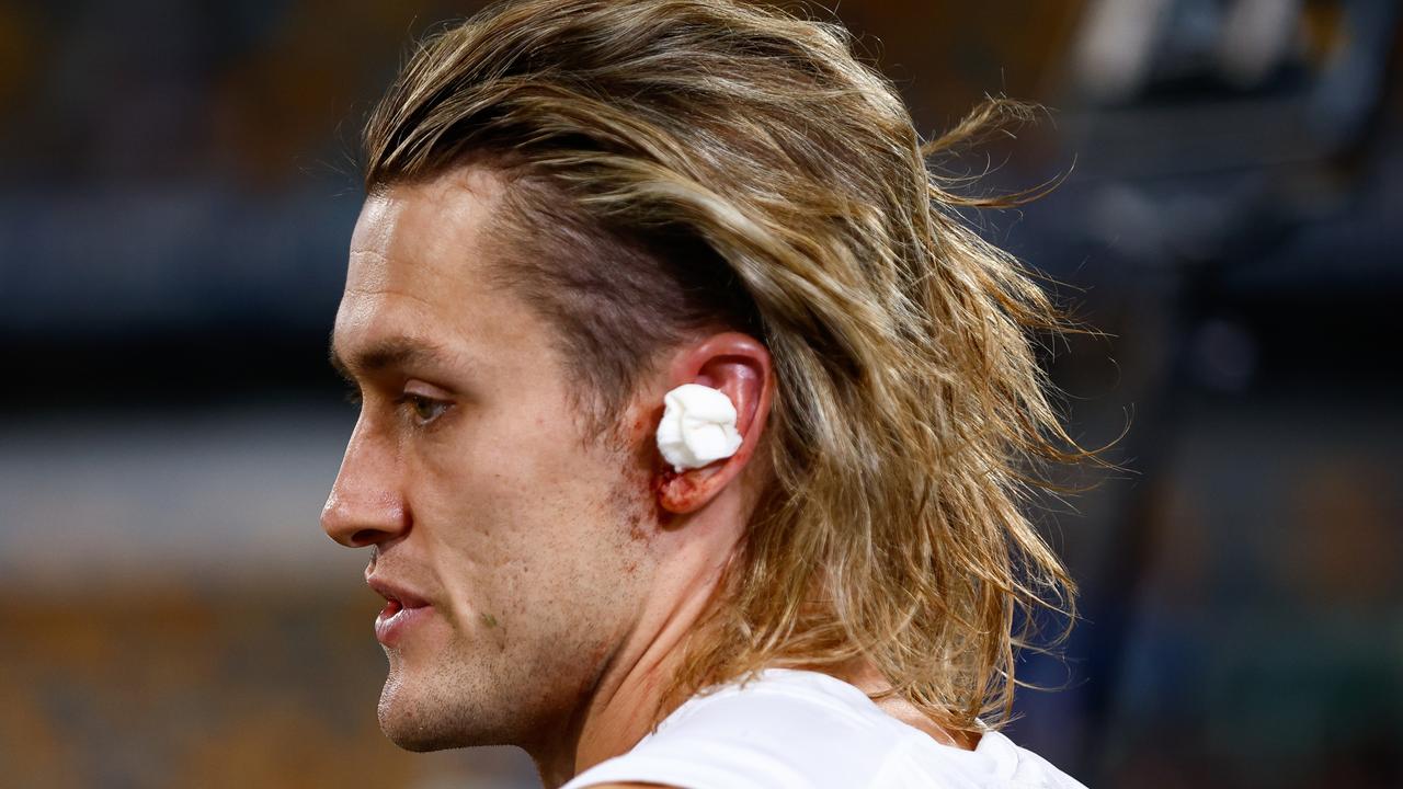 Darcy Moore has had an ear issue. Picture: Russell Freeman/AFL Photos via Getty Images