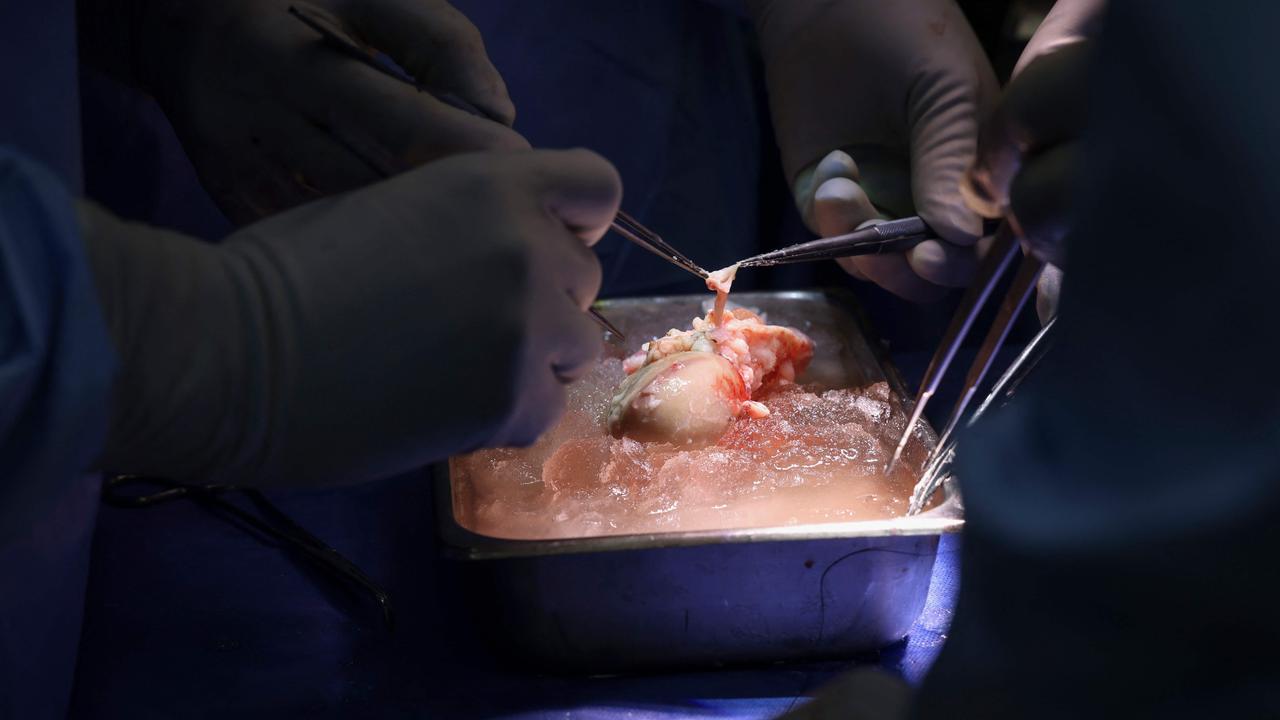 The genetically modified pig kidney sits on ice awaiting transplant in theatre. Picture: AFP Photo / Massachusetts General Hospital / Michelle Rose