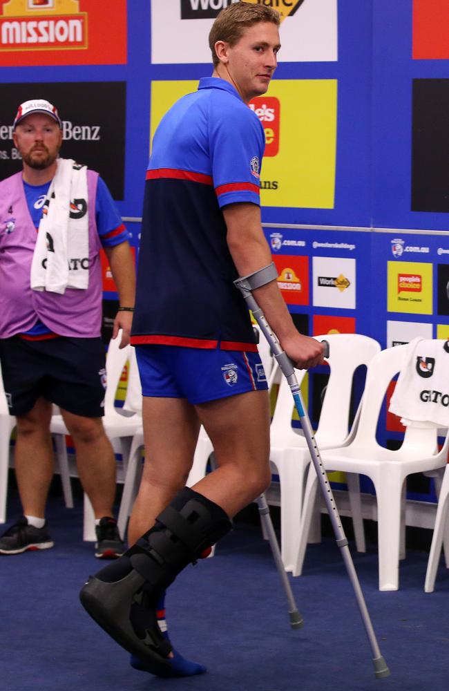 An injured Aaron Naughton in the rooms after the Bulldogs’ win over the Lions in Round 8.