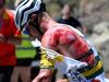 Cyclist covered in blood after horror crash