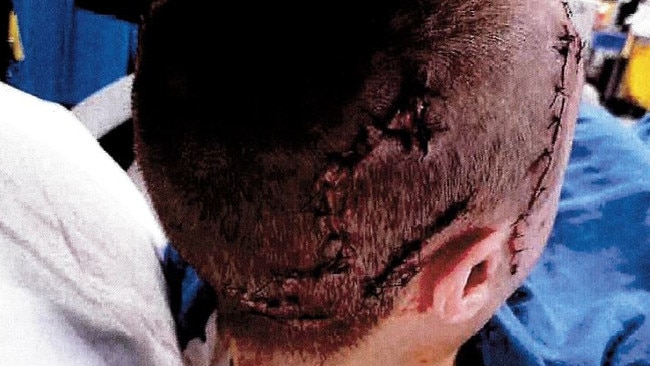 The victim suffered horrific injuries from several blows to the head. Picture: Supplied