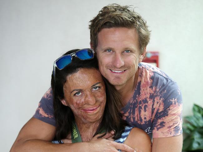 Turia Pitt talks about her Michael in memoir 'Unmasked' | news.com.au leading news site