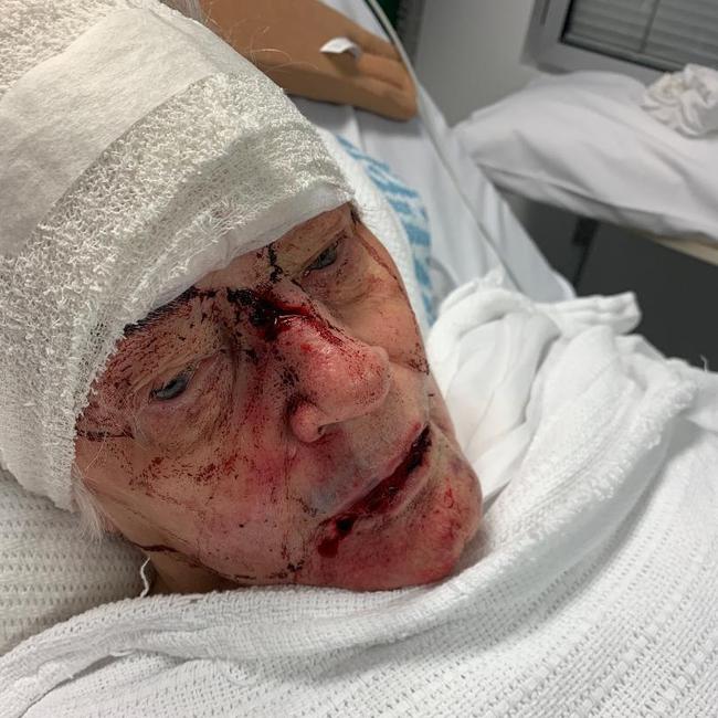 Patricia was left with shocking injuries. Picture: NSW Police