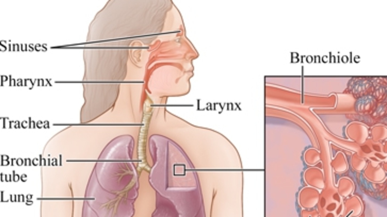 Images of the respiratory system, showing the bronchial tubes. Multiple autopsies showed Elly Warren had sand in her lower airways, including her bronchial tubes. Picture: Supplied