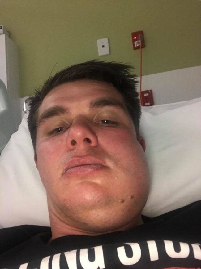 Trinity Old Scholars player Carl Teusner in hospital with a broken jaw. Picture: Supplied.