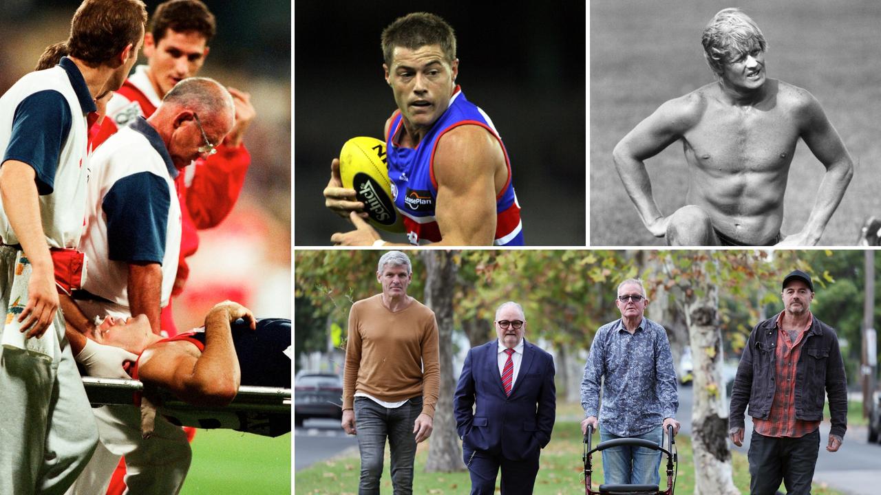 Code of silence: AFL fails concussion test