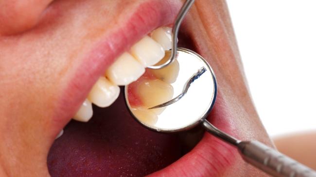 Dentists have branded the rebate freeze a dental tax by proxy. Picture News Corp.