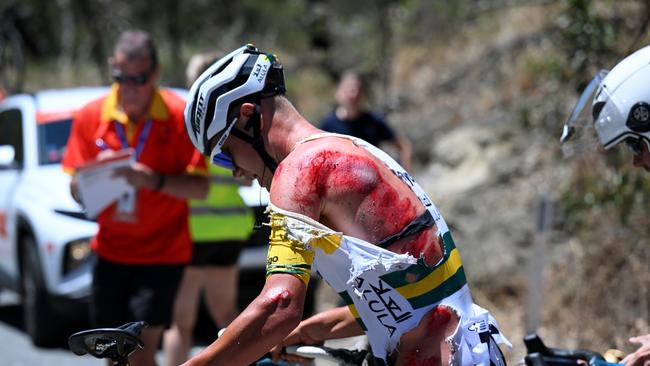 Luke Plapp was left bloodied after being involved in a crash during stage three. Picture: Getty Images