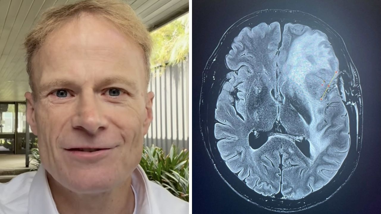 Former Australian of the Year gives grim health update
