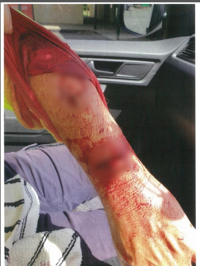 Australia Post has released images of some of the injuries.