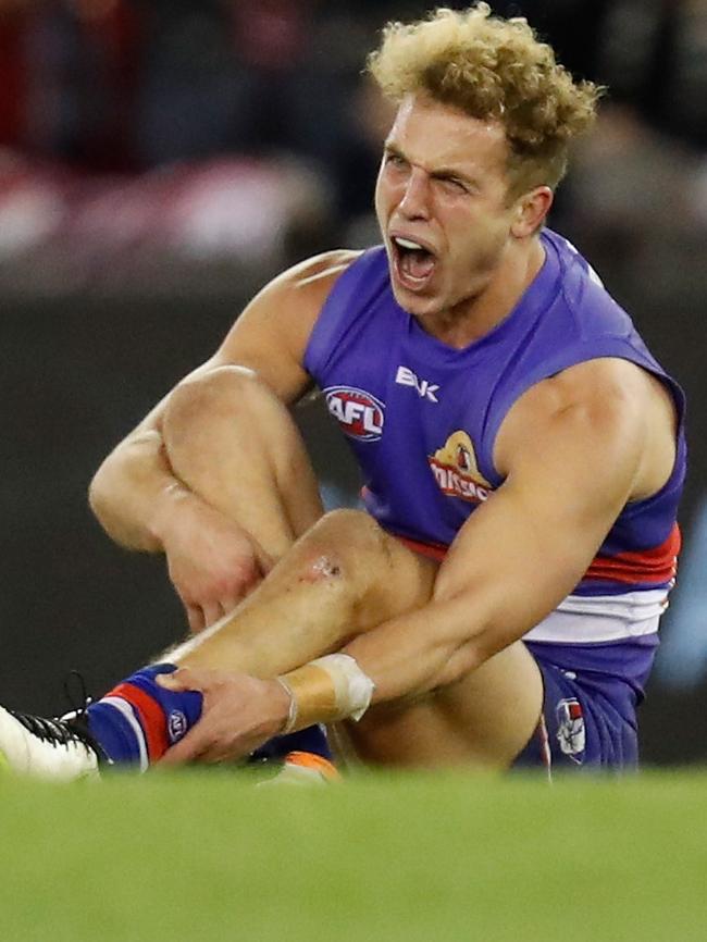 Mitch Wallis in the moments after breaking his leg. Getty Images