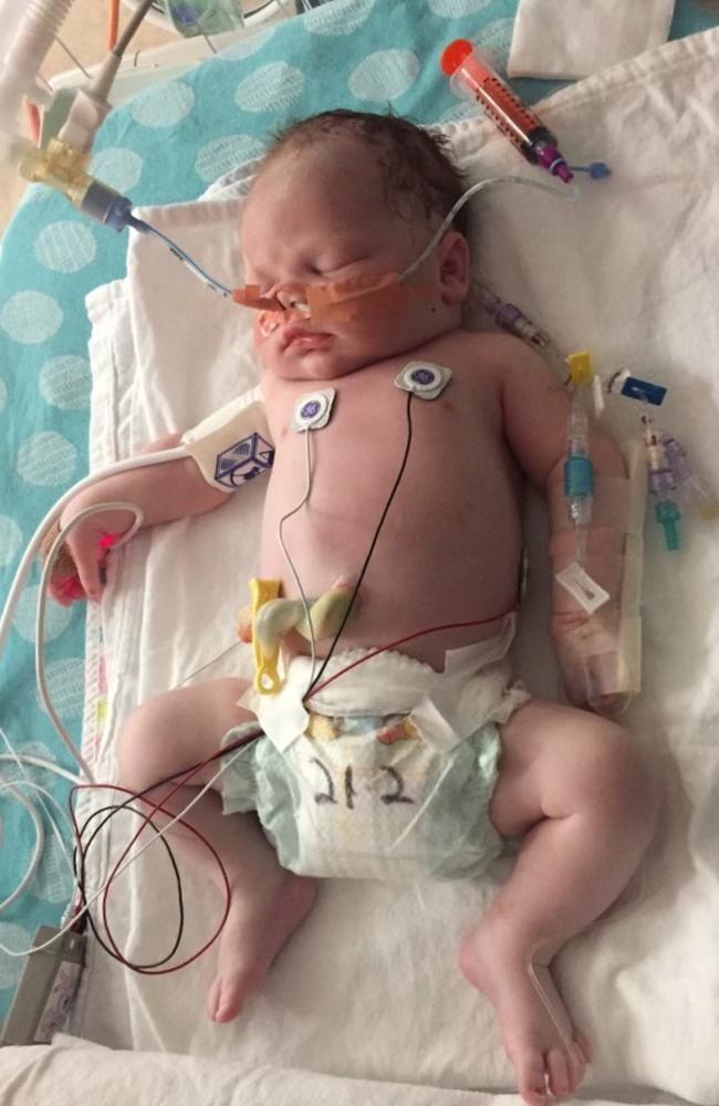 Eli Keed was treated by Doctor Michael in the ICU as a baby, where he was diagnosed with cancer from birth. Picture: Supplied