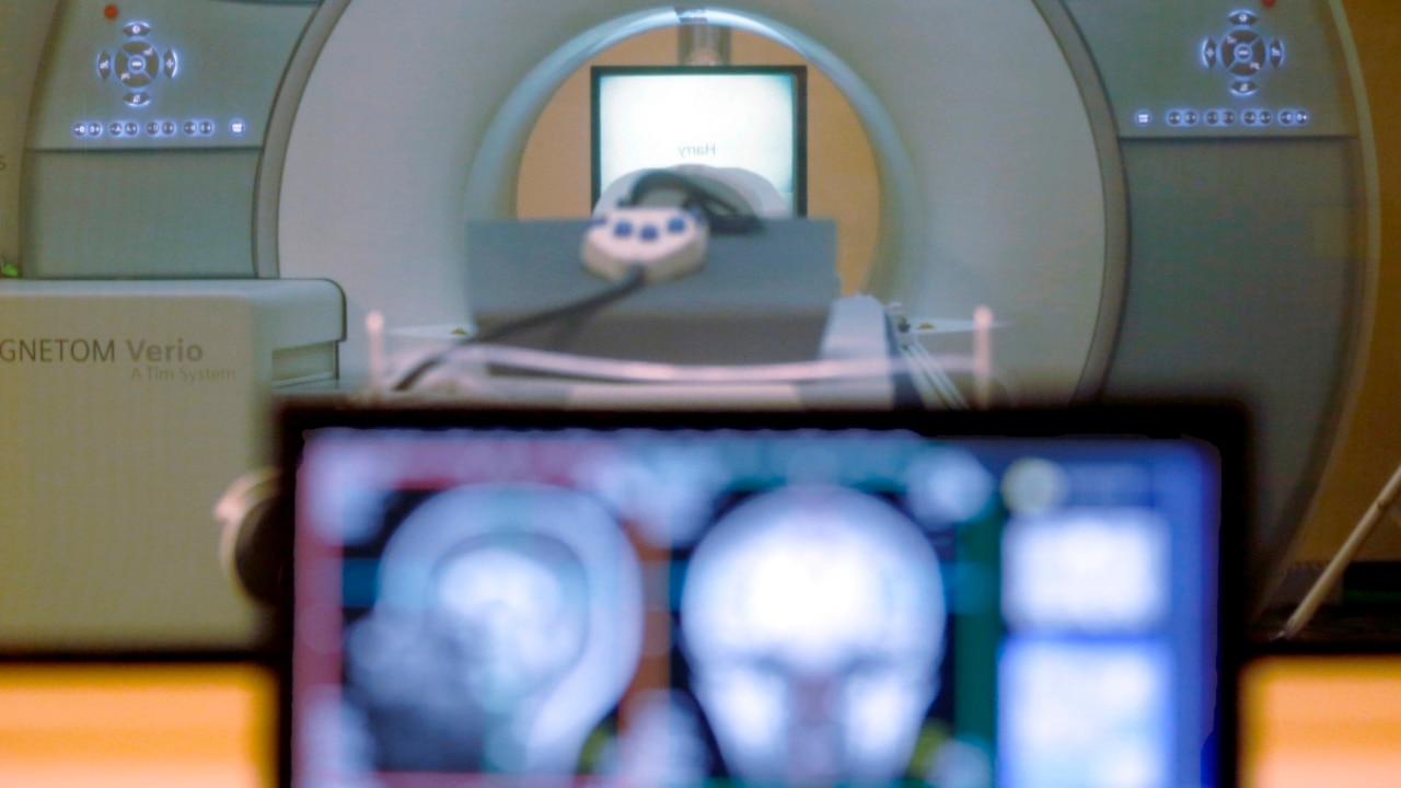 Labor unveils locations it will establish subsidised MRI machines